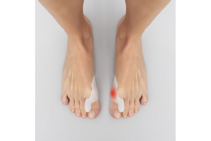 Silicone Bunion Corrector Protector...